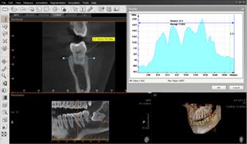 radiologia 3D